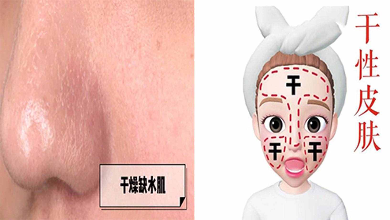 油田？干皮？混合肌？5秒测出你是什么肤质！也太准了吧？