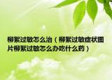 柳絮过敏怎么治（柳絮过敏症状图片柳絮过敏怎么办吃什么药）