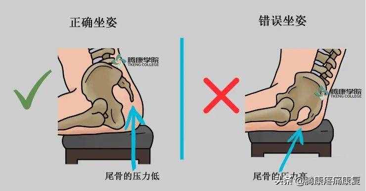 四个缓解尾骨疼痛的方法