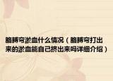 胳膊弯淤血什么情况（胳膊弯打出来的淤血能自己挤出来吗详细介绍）