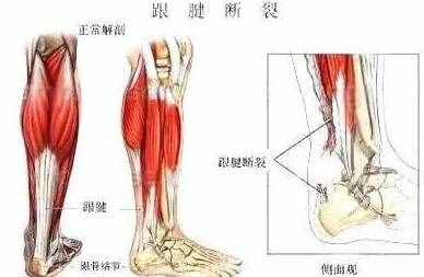 常见的几种足底疼痛，哪些原因引起的呢？