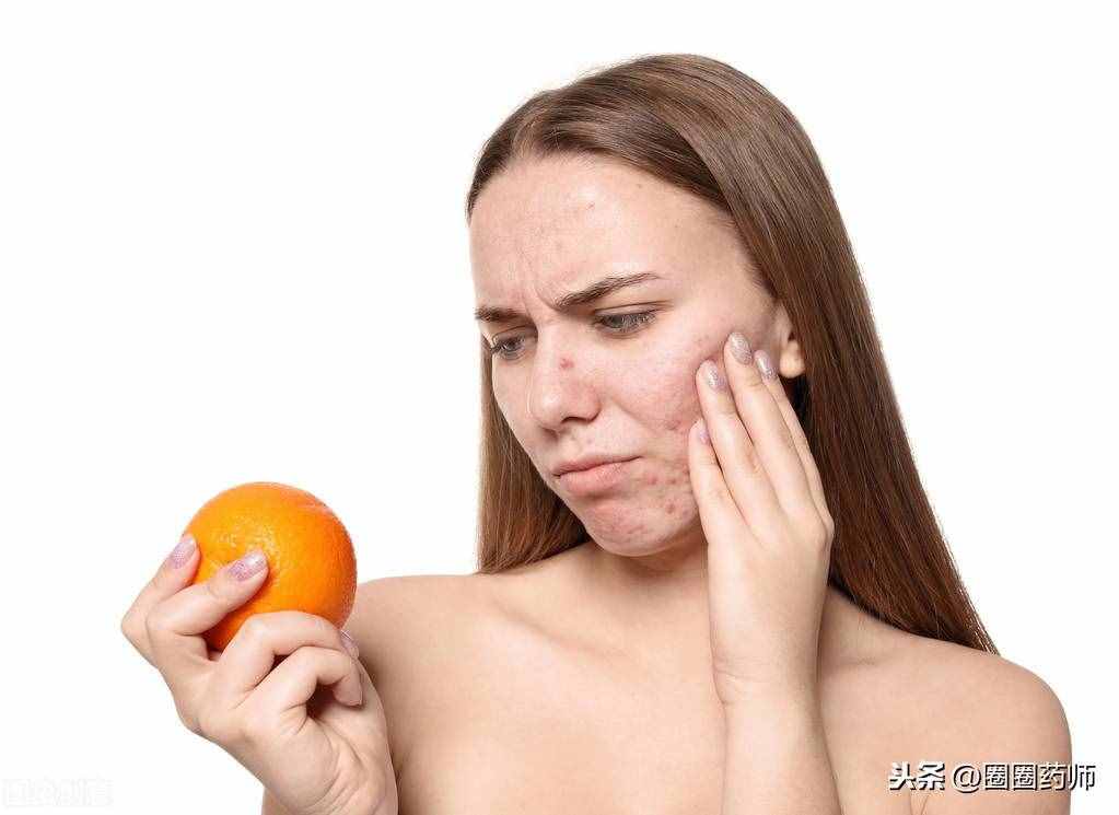 皮肤过敏怎么办？