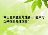 今日更新查胎儿性别（B超单可以辨别胎儿性别吗）