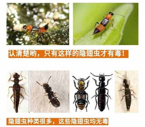 隐翅虫咬人致命？别再误传了！真相都在这里