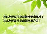 怎么判断是不是过敏性紫癜图片（怎么判断是不是蟑螂详细介绍）