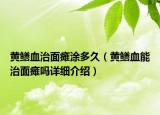黄鳝血治面瘫涂多久（黄鳝血能治面瘫吗详细介绍）
