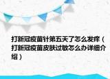 打新冠疫苗针第五天了怎么发痒（打新冠疫苗皮肤过敏怎么办详细介绍）
