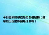 今日更新眩晕症是怎么引起的（眩晕症出现的原因是什么呢）