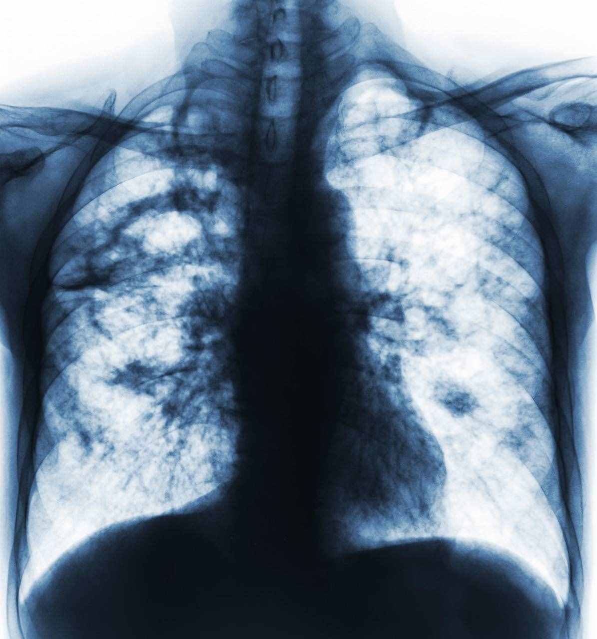 什么是临床诊断病例？
