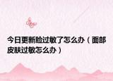 今日更新脸过敏了怎么办（面部皮肤过敏怎么办）