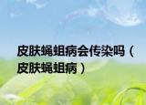 皮肤蝇蛆病会传染吗（皮肤蝇蛆病）