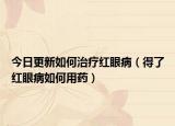今日更新如何治疗红眼病（得了红眼病如何用药）