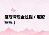痤疮清理全过程（痤疮 痤疮）