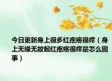 今日更新身上很多红疙瘩很痒（身上无缘无故起红疙瘩很痒是怎么回事）
