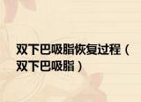 双下巴吸脂恢复过程（双下巴吸脂）