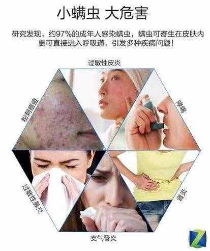 天气渐凉 如何防螨除螨？