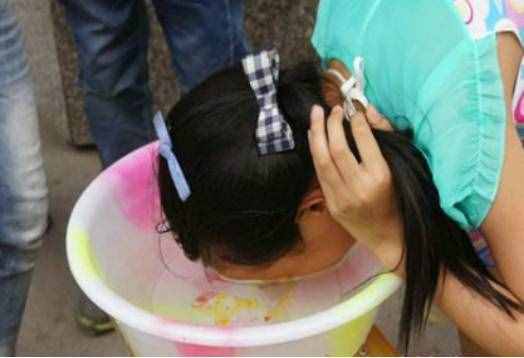 学生怎么祛痘痘？每天5毛钱让你轻松祛痘不留痕