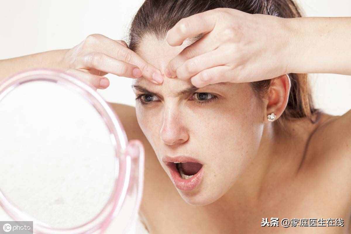 如何能“消灭”青春痘？皮肤专家教你几招，让你“战痘”到底