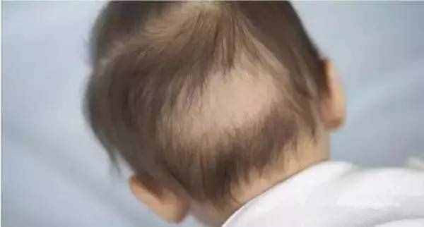 崔玉涛的17个育儿知识问与答，妈妈学习！