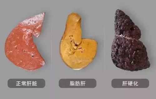 人体肝脏的主要功能