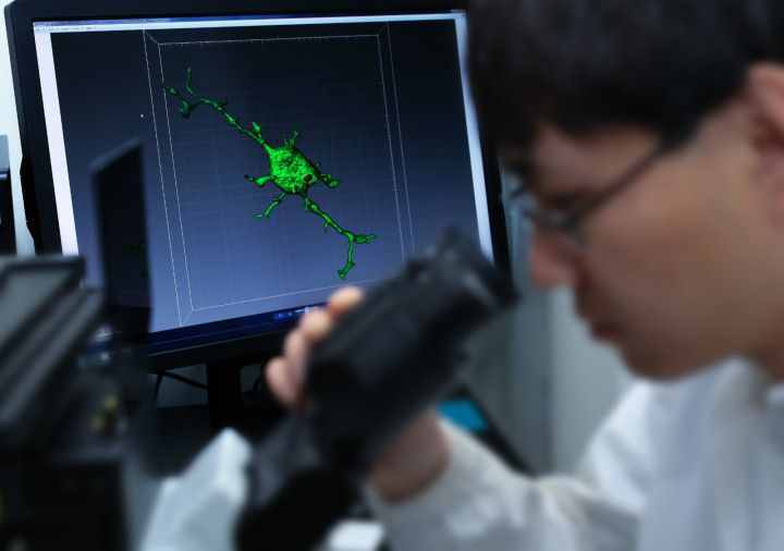 我们为什么会遗忘？原来是大脑中的免疫细胞在作怪 浙大重大研究成果在国际顶级期刊上发布