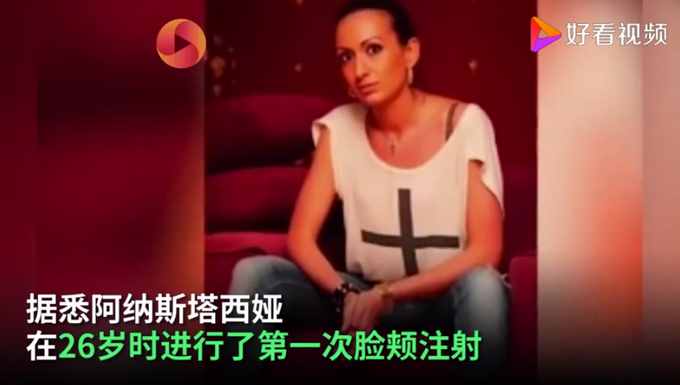 乌克兰网红模特自称拥有世界最大脸颊，网友们看法不一