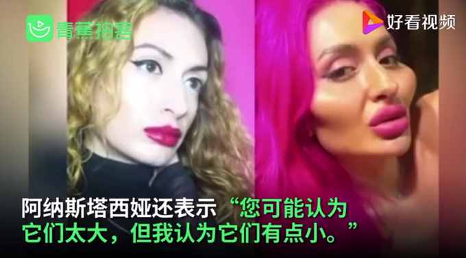 乌克兰网红模特自称拥有世界最大脸颊，网友们看法不一