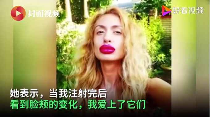 乌克兰网红模特自称拥有世界最大脸颊，网友们看法不一