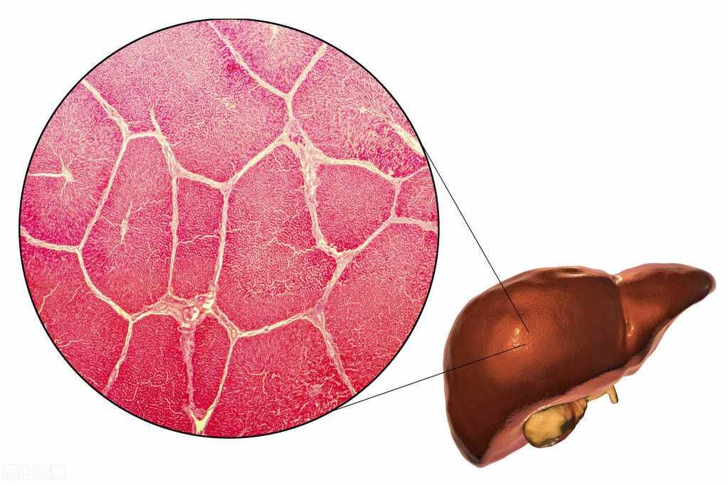 肝硬化一般寿命有多长？1年、2年还是多久？一文全知晓，涨知识