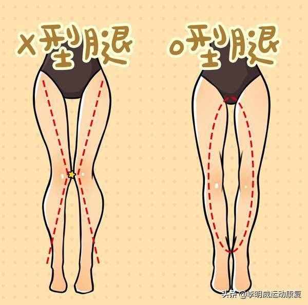 如何瘦小腿？原因和练习方案
