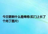 今日更新什么是痔疮(肛门上长了个肉丁图片)