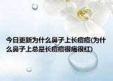 今日更新为什么鼻子上长痘痘(为什么鼻子上总是长痘痘很痛很红)