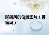 脚痛风的位置图片（脚痛风）