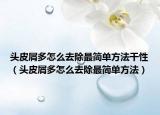 头皮屑多怎么去除最简单方法干性（头皮屑多怎么去除最简单方法）
