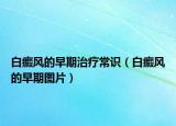 白癜风的早期治疗常识（白癜风的早期图片）