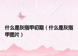 什么是灰指甲初期（什么是灰指甲图片）