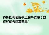 教你如何去除手上的牛皮癣（教你如何去除草莓鼻）
