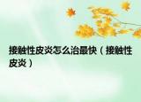 接触性皮炎怎么治最快（接触性皮炎）