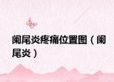 阑尾炎疼痛位置图（阑尾炎）