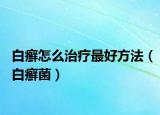 白癣怎么治疗最好方法（白癣菌）