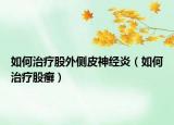 如何治疗股外侧皮神经炎（如何治疗股癣）