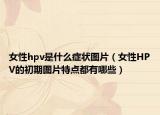 女性hpv是什么症状图片（女性HPV的初期图片特点都有哪些）