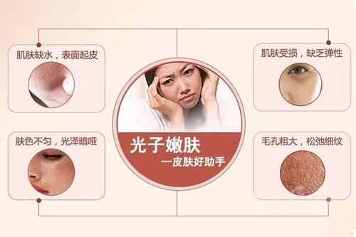 带你了解光子嫩肤