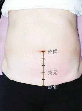 中医穴位绿色疗法強身健体之关元穴