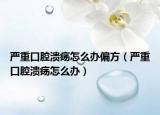 严重口腔溃疡怎么办偏方（严重口腔溃疡怎么办）