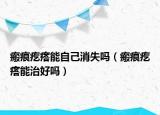 瘢痕疙瘩能自己消失吗（瘢痕疙瘩能治好吗）