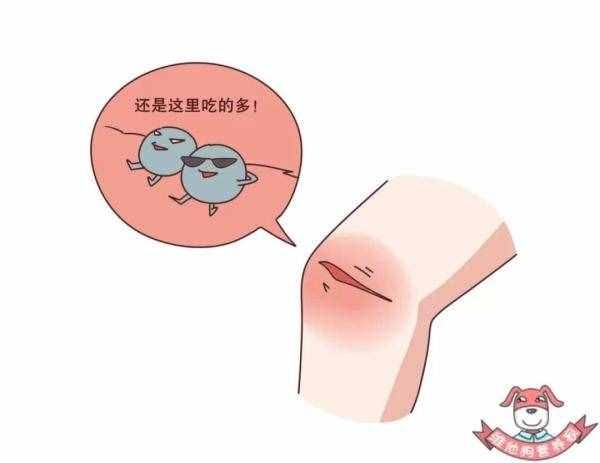 不知不觉得了糖尿病？这些早期症状你要了解