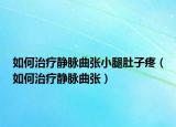 如何治疗静脉曲张小腿肚子疼（如何治疗静脉曲张）