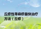 丘疹性荨麻疹最快治疗方法（丘疹）