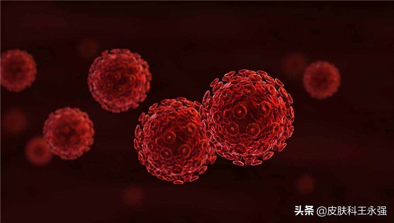 艾滋病患者，前期会有哪些表现？怎样正确的预防，医生一步步教你
